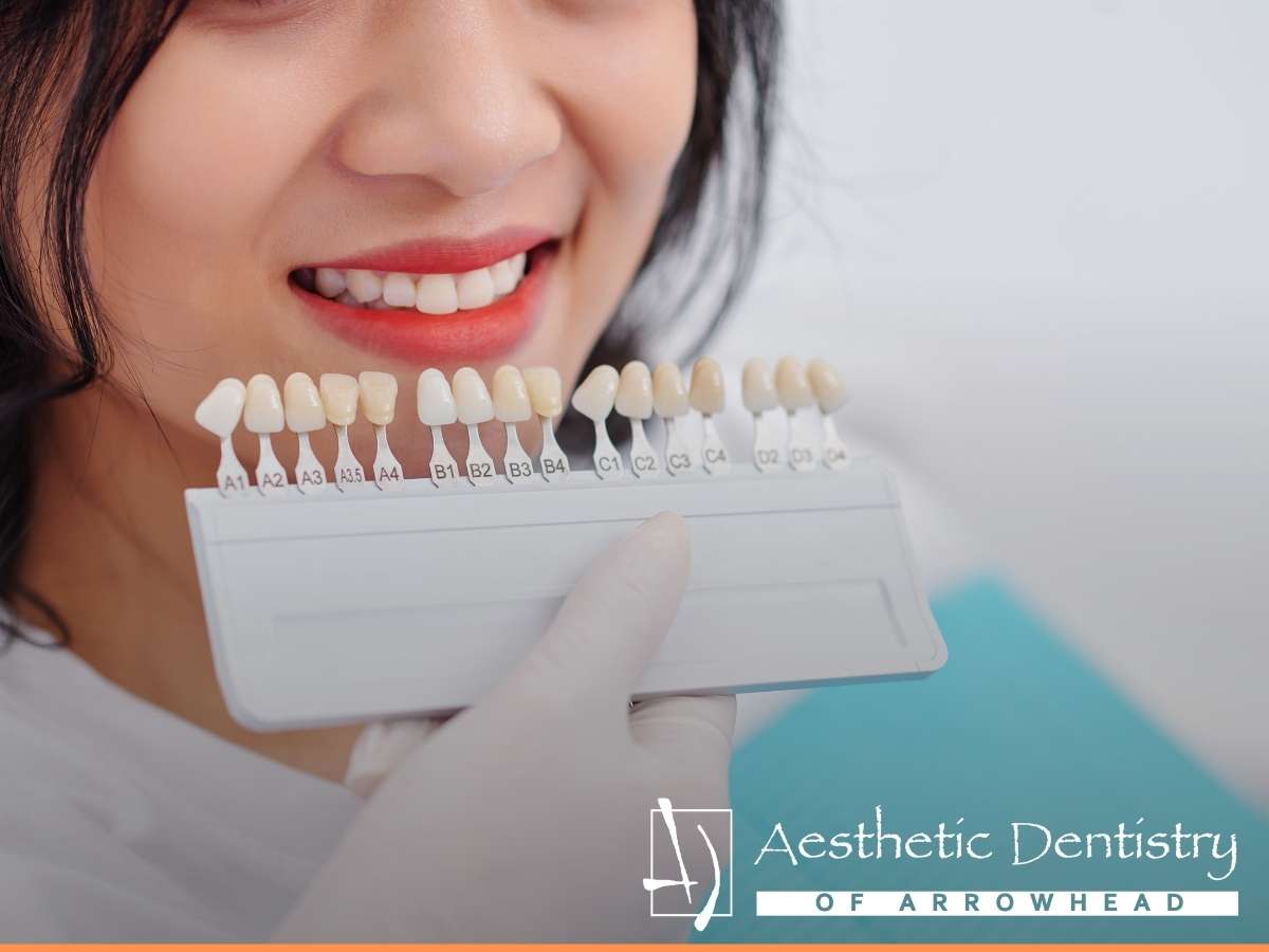 Get Your Teeth Whitened With Aesthetich Dentistry Of Arrowhead