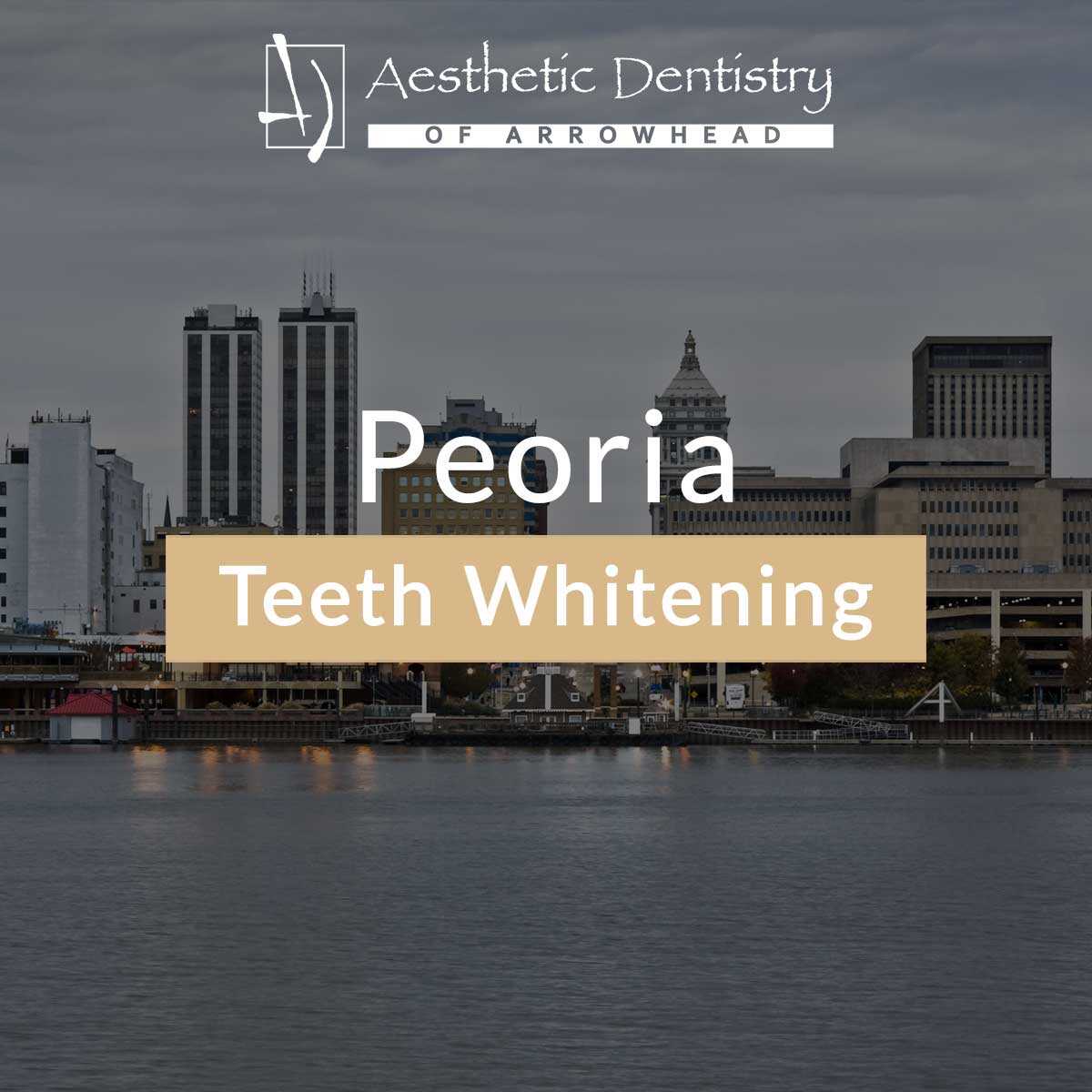 Peoria Teeth Whitening featured image