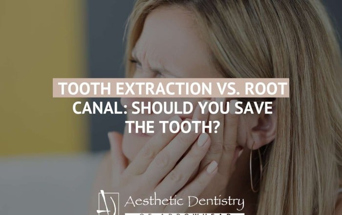 Tooth Extraction Vs. Root Canal Should You Save The Tooth