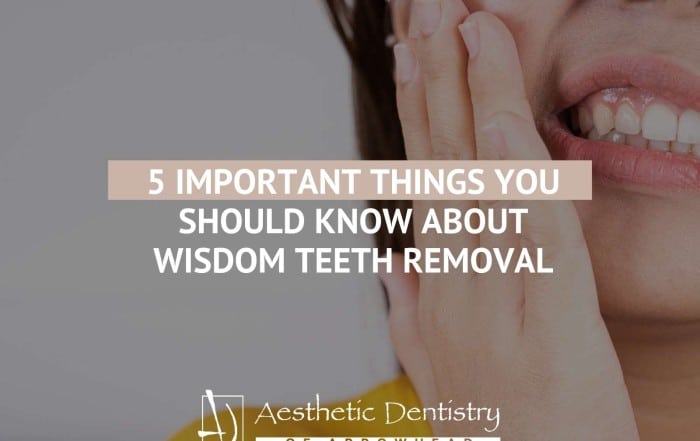 5 Important Things You Should Know About Wisdom Teeth Removal