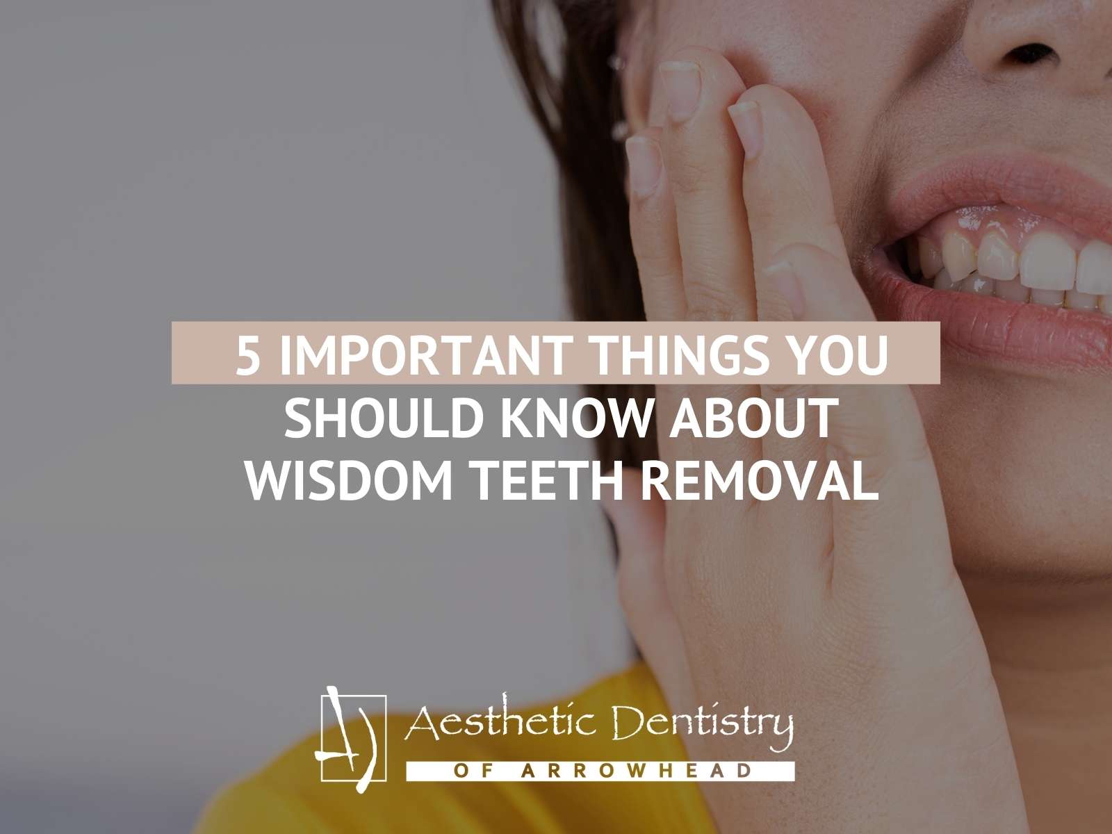 5 Important Things You Should Know About Wisdom Teeth Removal