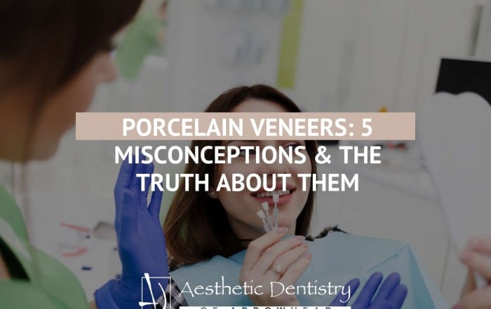 Porcelain Veneers 5 Misconceptions & The Truth About Them