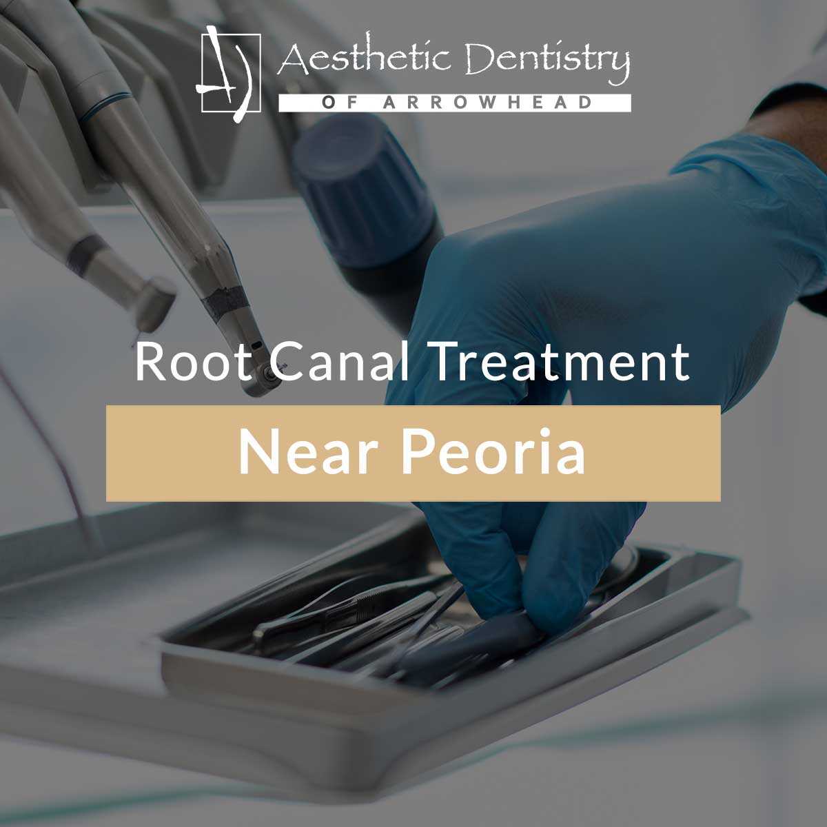 Root Canal Treatment Near Peoria featured image