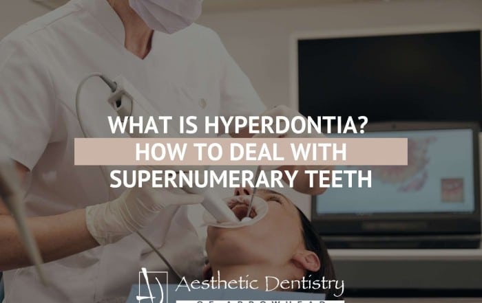 What Is Hyperdontia? How To Deal With Supernumerary Teeth
