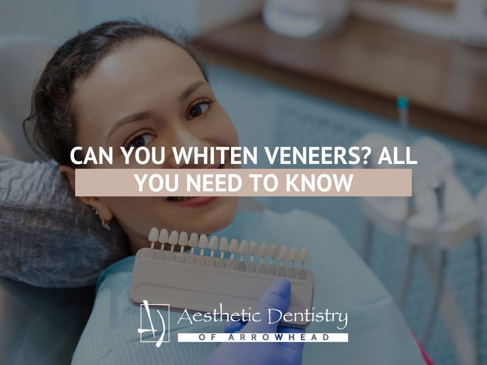 Can You Whiten Veneers All You Need To Know