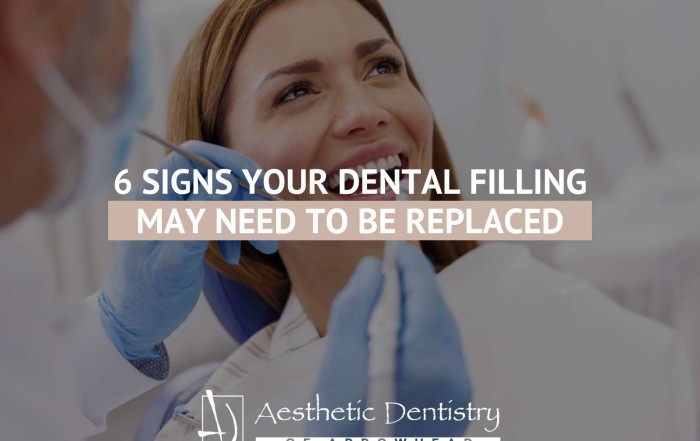 6 Signs Your Dental Filling May Need To Be Replaced