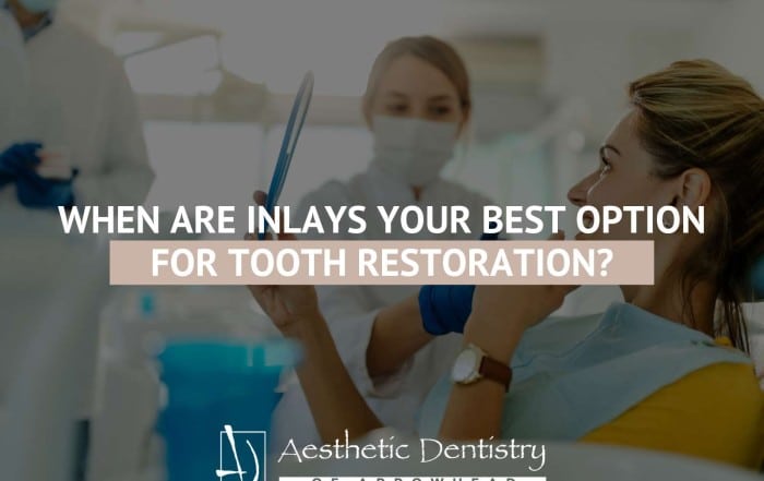 When Are Inlays Your Best Option For Tooth Restoration?