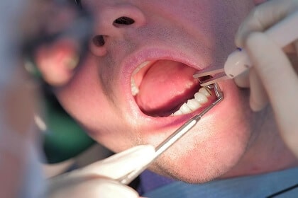 Over 15 Years Of Experience Treating Periodontal Disease-img