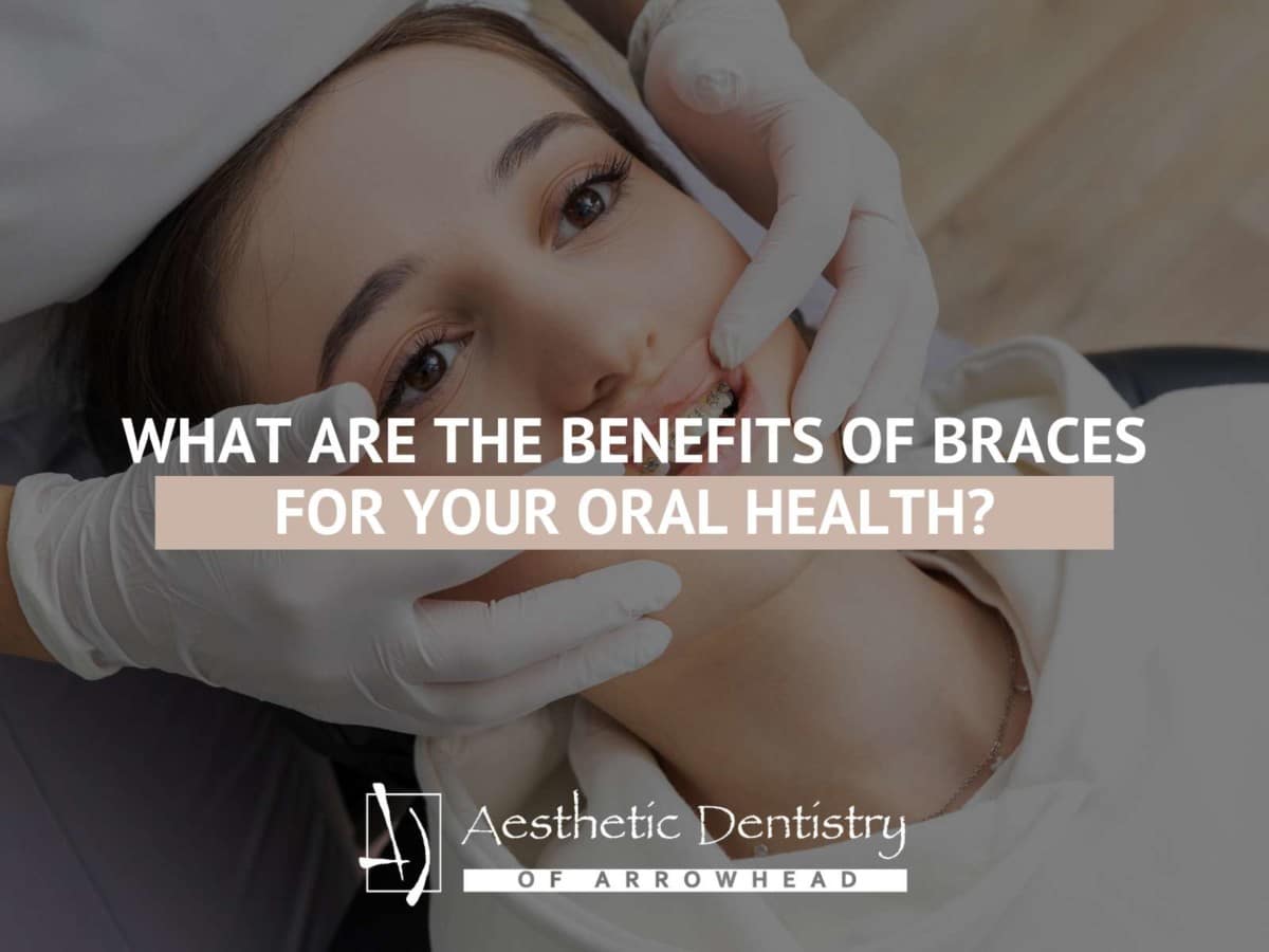 What Are The Benefits Of Braces For Your Oral Health?