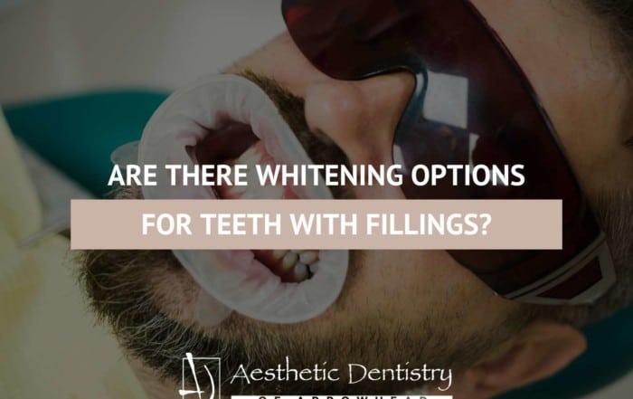 Are There Whitening Options For Teeth With Fillings