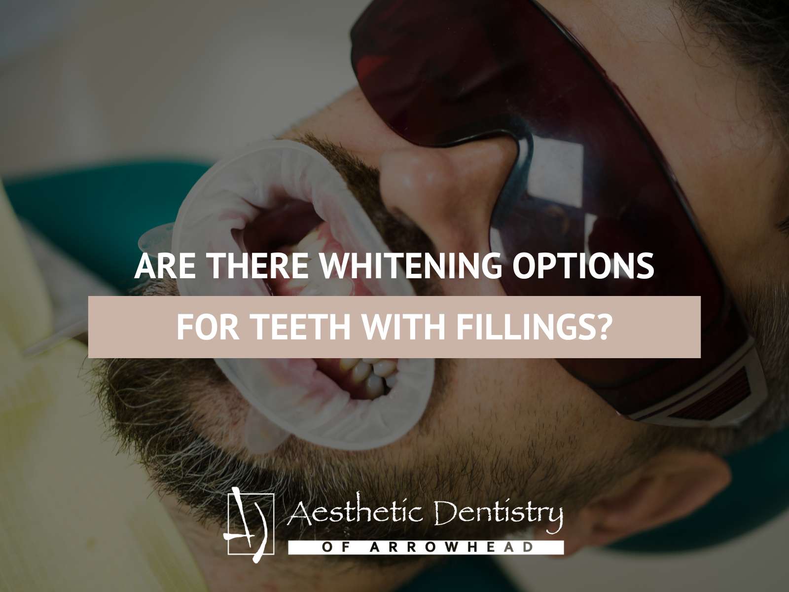 Are There Whitening Options For Teeth With Fillings