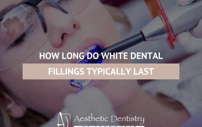 How Long Do White Dental Fillings Typically Last