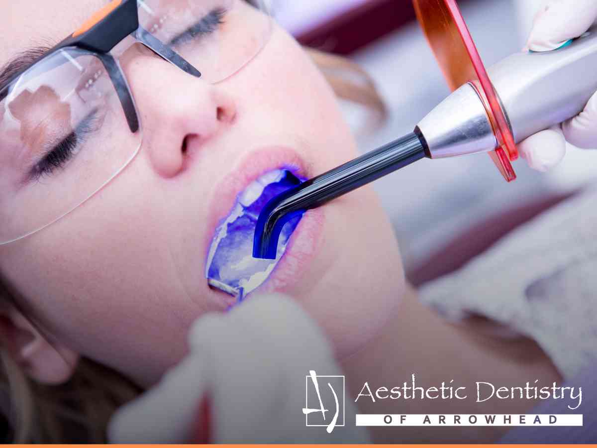 Dentist applying a white dental filling to a patient's tooth using a curing light.
