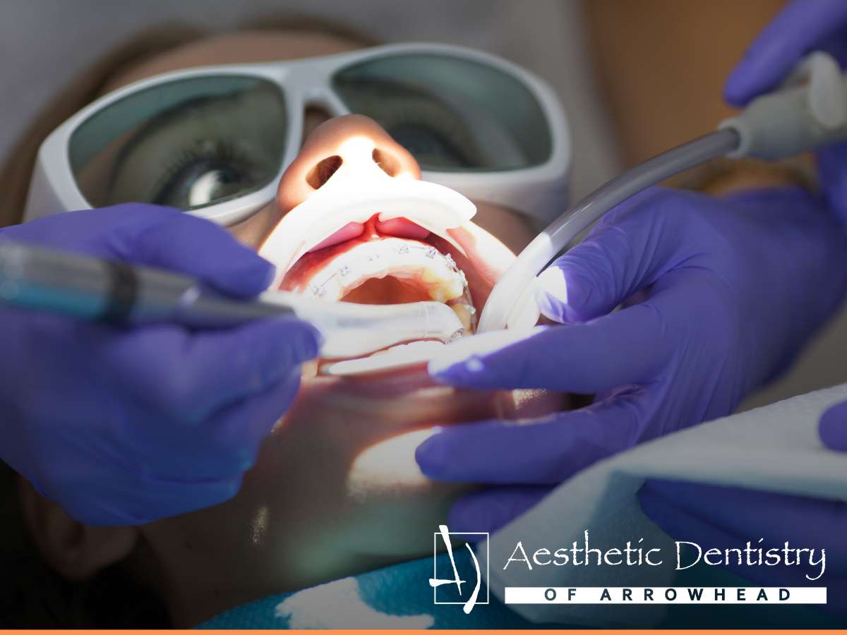 Dentist performing gum therapy on a patient at Aesthetic Dentistry of Arrowhead